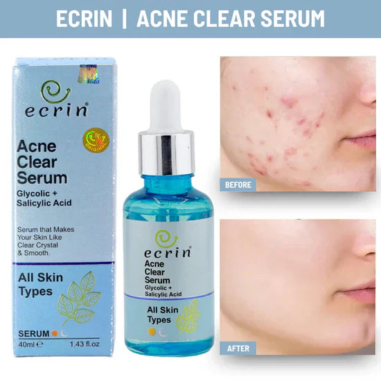 Ecrin acne clear serum - 40ml - Best Result